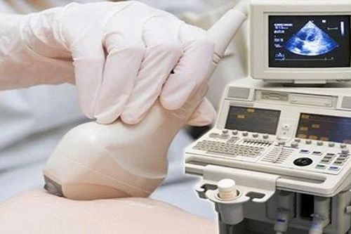 Chẩn đoán ung thư vú đồng thời hai bên giai đoạn sớm
