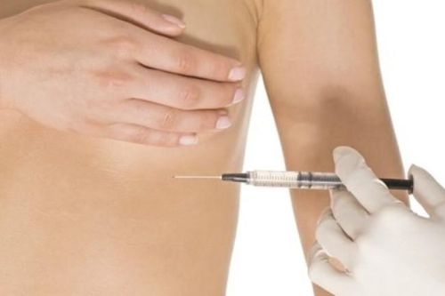 Tiêm filler nâng ngực đón Tết, người phụ nữ nhập viện vì áp xe nặng