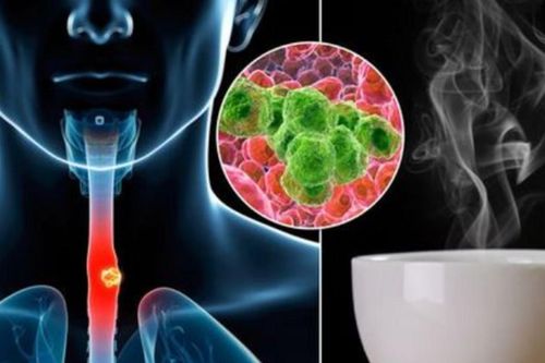 Cảnh báo mới về uống đồ nóng: Nguy cơ gây ung thư!