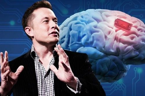 Chip não của Elon Musk sắp sản xuất hàng loạt