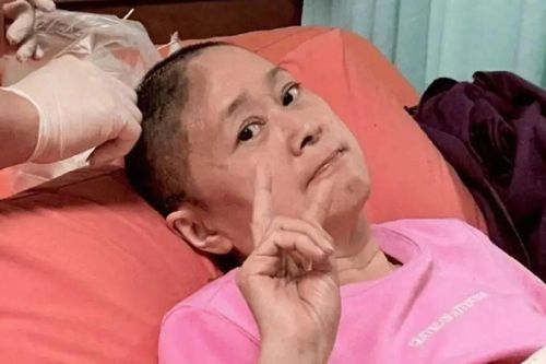 Diễn viên Vương Nguyệt 'Vườn sao băng' ngã chấn thương, mất một phần hộp sọ