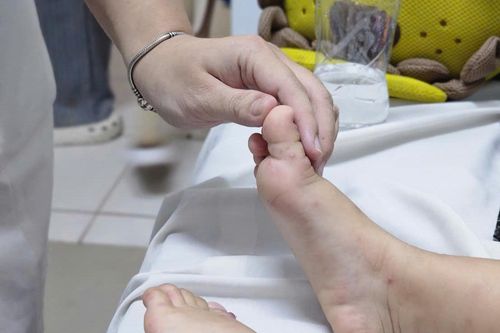 Cách chăm sóc trẻ mắc tay chân miệng