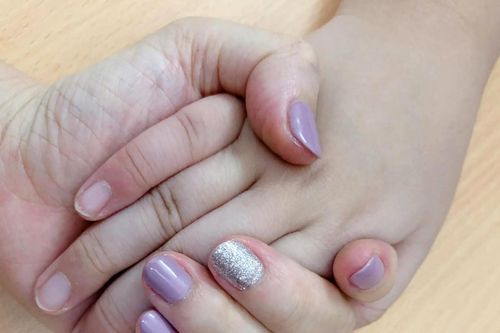 5 thay đổi nhỏ ở bàn tay có thể là tiếng kêu cứu sớm của cơ thể