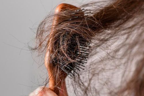 3 cách đơn giản ngăn rụng tóc