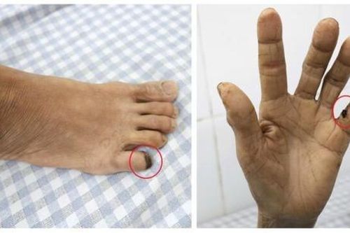 Người phụ nữ 60 tuổi 'cứng hàm' suýt mất mạng vì bị gà đá