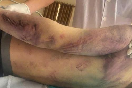 Đừng bắt trẻ em trưởng thành từ đau đớn
