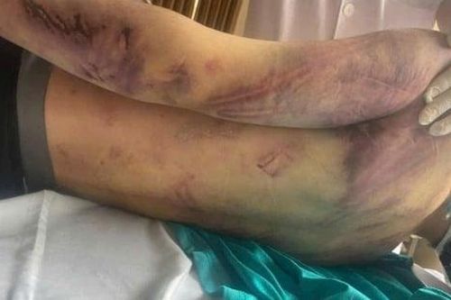 Xử lý nghiêm vụ việc tại Trung tâm công tác xã hội Hải Hà tại Quảng Ninh