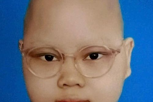 Mở rộng lòng từ: Nhà nghèo bị bệnh ung thư não