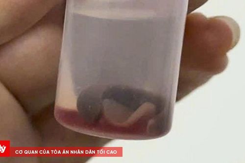 Phát hiện sinh vật lạ sống ký sinh trong hốc mũi người đàn ông