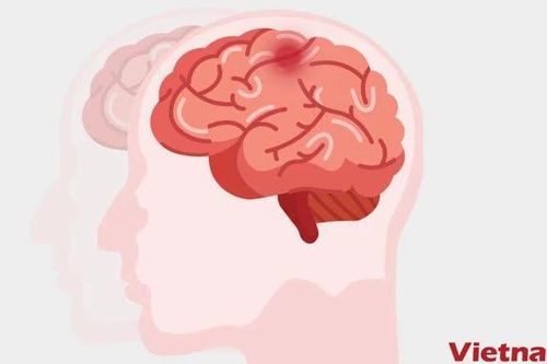 Những thực phẩm tốt nhất cho sức khỏe não bộ của bạn sau tuổi 40