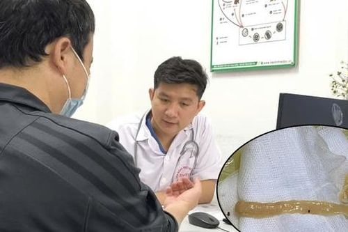 Người đàn ông hay ăn đồ sống và tiết canh, nhiễm sán dây gần 1m