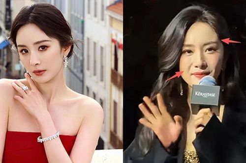 Diễn viên Dương Mịch tuổi 40 lộ gương mặt sưng phù khác lạ
