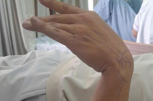 Ngủ gật trên bàn làm việc 30 phút, người đàn ông 'tá hỏa' khi phát hiện tay bị liệt