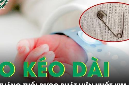 Ho kéo dài nhiều tháng, bé trai 7 tháng tuổi được phát hiện nuốt kim băng sát động mạch chủ