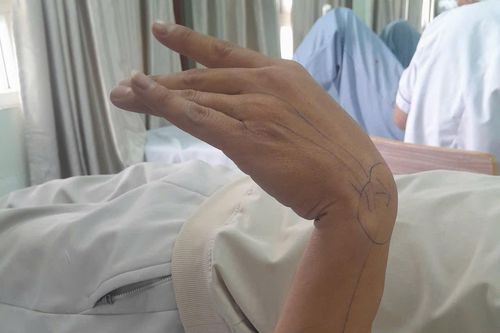 Người đàn ông gánh hậu quả không ngờ chỉ sau 30 phút ngủ gật