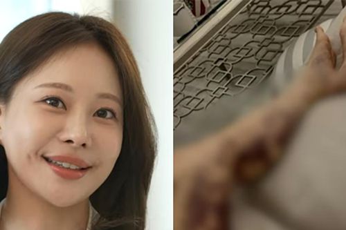 YouTuber Aori lần đầu hé lộ biến chứng y khoa và hành trình kiện tụng 12 tỷ won