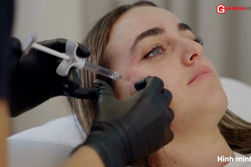 Không tiêm botox khi chưa biết 3 tác dụng phụ này