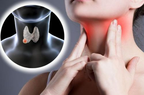 Chuyên gia chỉ cách ổn định nhân tuyến giáp: Không to lên, không biến chứng