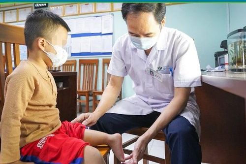 Xoay cẳng chân 180 độ cho bé trai 5 tuổi mắc thiểu sản xương đùi bẩm sinh