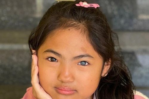 Một ngày đến trường bình dị của cô bé có đôi mắt 'âm dương' ở Đắk Lắk