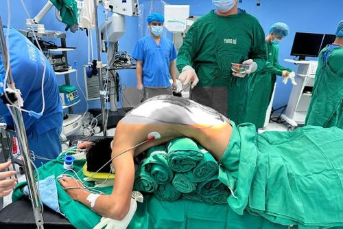 10 giờ đồng hồ 'duỗi' thẳng lưng cho người đàn ông có cột sống cong như cành cây