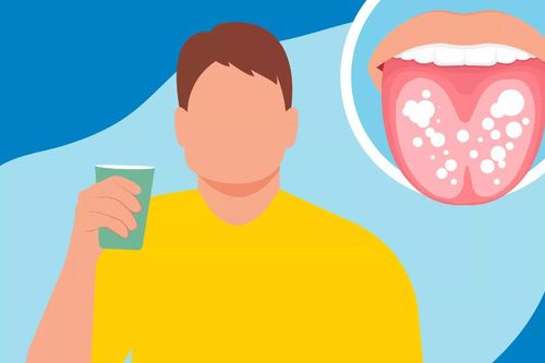 Người Việt còn chủ quan với bệnh lý răng miệng