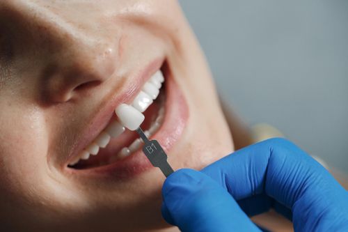 Việt kiều Mỹ về TP.HCM làm răng sứ