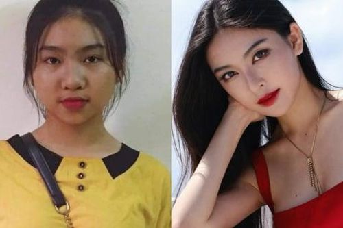 Lộ hình hotgirl Linh Trương thời chưa phẫu thuật thẩm mỹ