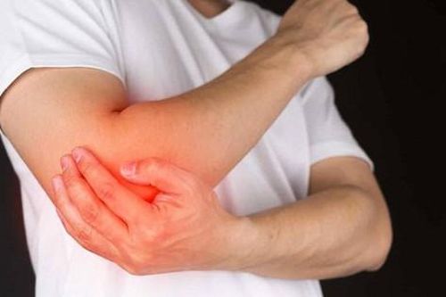 Cứng khớp khuỷu tay chữa cách nào?