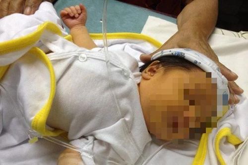 Phẫu thuật thành công cho trẻ 19 tháng mắc nang ống mật chủ hiếm gặp
