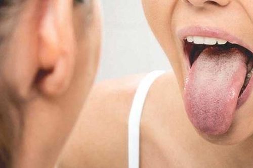 Bị ung thư lưỡi di căn hạch do chủ quan từ vết loét nhỏ