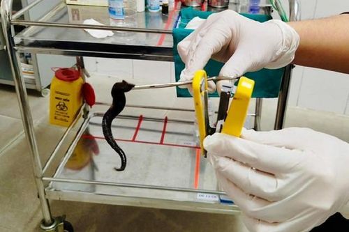Đi khám, người đàn ông sốc nặng khi thấy thứ đáng sợ trong mũi mình