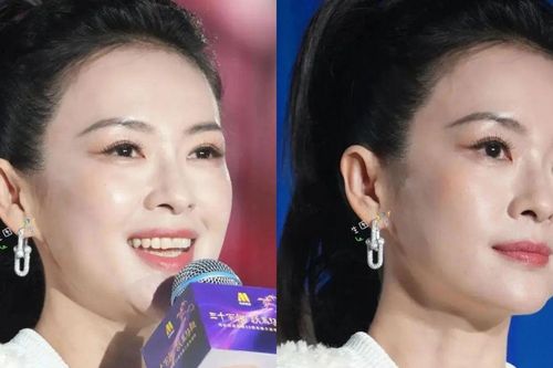 Chương Tử Di gây sốc với gương mặt sưng phù, khác lạ ở tuổi 47