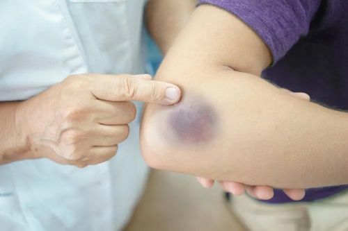 Nhóm người cần đi khám gan sớm và thường xuyên
