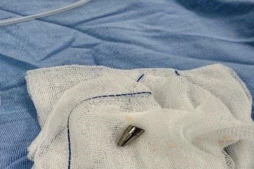 Kịp thời cứu sống bé 7 tuổi hóc ngòi bút rơi vào đường thở