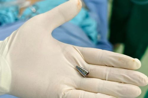 Cấp cứu bé 7 tuổi bị hóc đầu ngòi bút