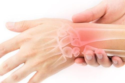 Biểu hiện viêm khớp tự phát thiếu niên ở trẻ em