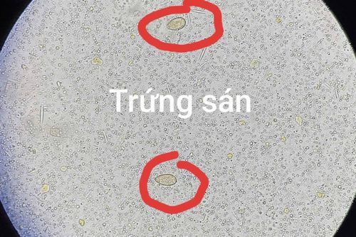 Thói quen xấu khó bỏ khiến người đàn ông hư gan, sán chi chít