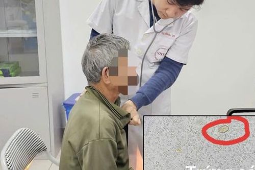 Ổ sán trong đường mật người đàn ông hay ăn đồ tái sống