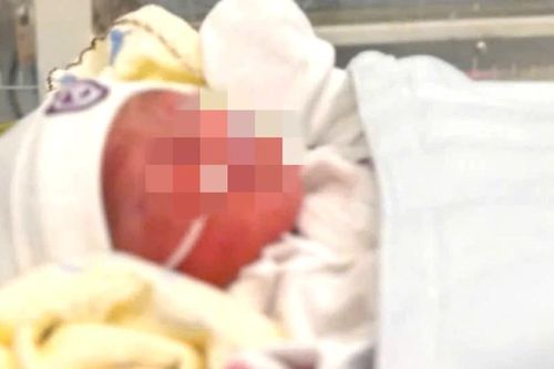 Gia Lai: Tìm người thân bé gái sơ sinh bọc trong túi nilon ở cầu treo