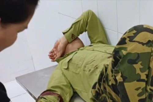 Truy đuổi đối tượng nghi vấn, nhân viên bảo vệ rừng bị chém thương tích