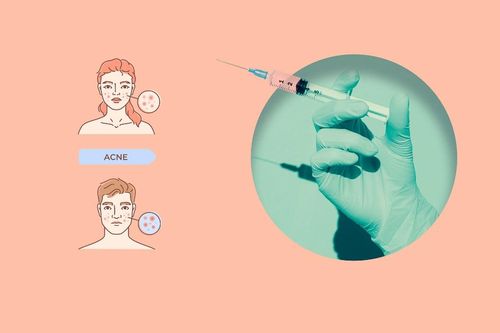 Không chỉ giới trẻ quan tâm: Vaccine trị mụn