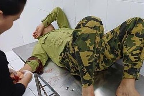 Xử lý nghiêm vụ việc dùng dao chém trọng thương nhân viên bảo vệ rừng
