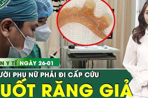 Bản tin Y tế 26/1: Người phụ nữ hoảng hốt khi nuốt phải hàm răng giả