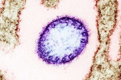 Những rào cản khiến virus Nipah chưa có vaccine