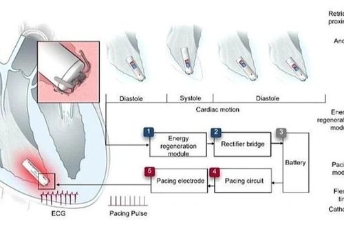 Trung Quốc nghiên cứu thành công máy tạo nhịp tim tự cấp điện siêu nhỏ