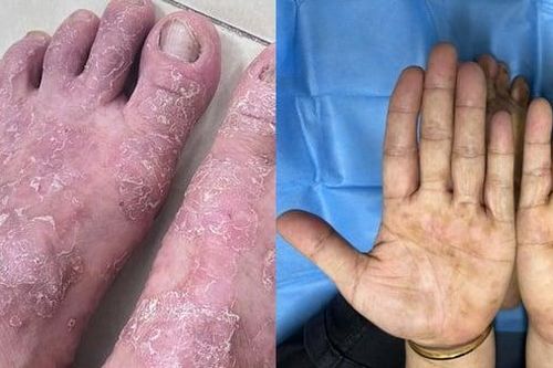 Trời lạnh, nhiều người nhập viện vì căn bệnh này