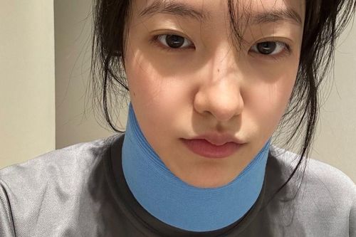 Nữ ca sĩ bị gãy cổ trong lúc tập luyện, người hâm mộ bàng hoàng