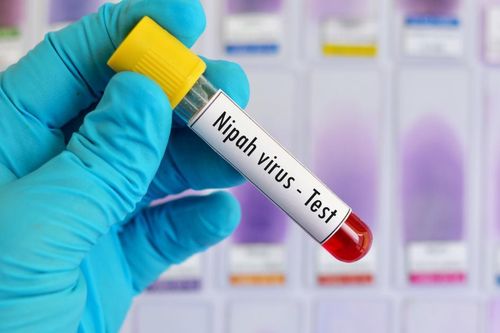 Không chủ quan với virus mới