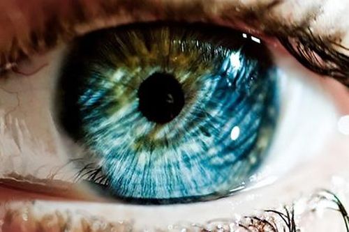 Đỏ, sưng đau mắt: Cảnh báo viêm mống mắt cần khám sớm